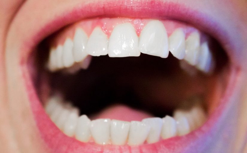 Nowoczesna technologia wykorzystywana w salonach stomatologii estetycznej być może spowodować, że odzyskamy ładny uśmiech.